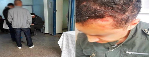 تهشيم رأس قائد على يد "سودور" يجر الأخير للإعتقال تهشيم رأس قائد على يد "سودور" يجر الأخير للإعتقال