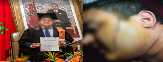 دكتور بجامعة محمد الأول يتعرض لاعتداء شنيع بالسلاح الأبيض دكتور بجامعة محمد الأول يتعرض لاعتداء شنيع بالسلاح الأبيض
