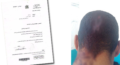 عائلة من إفرني بالدريوش تطالب وزارة العدل بالنظر في قضيتها وإنصافها جراء الهجوم والاعتداء عليها عائلة من إفرني بالدريوش تطالب وزارة العدل بالنظر في قضيتها وإنصافها جراء الهجوم والاعتداء عليها
