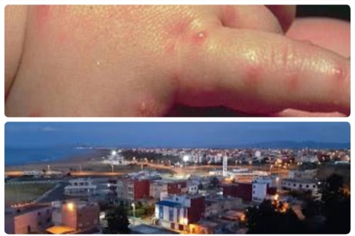 ساكنة قابوياوا تشكو هجوم أسراب من البعوض على البلدة ساكنة قابوياوا تشكو هجوم أسراب من البعوض على البلدة