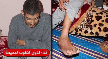 عائل أسرة مقعد عن العمل يعاني اعتلال الكليتين وضعف البصر وتورم القدم يناشدكم مساعدته عائل أسرة مقعد عن العمل يعاني اعتلال الكليتين وضعف البصر وتورم القدم يناشدكم مساعدته