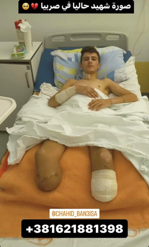 شهيد بحاجة للمساعدة.. مهاجر مغربي يعيش العذاب في صربيا بعد بتر الجيش لساقيه شهيد بحاجة للمساعدة.. مهاجر مغربي يعيش العذاب في صربيا بعد بتر الجيش لساقيه