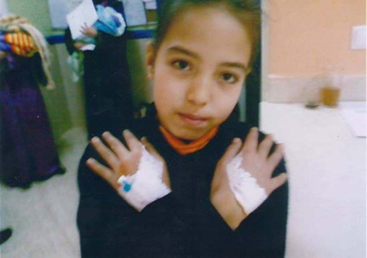 طفلة ذات 10 سنوات تعاني مرض الأنيميا تستنجد بكم لمساعدتها على العلاج