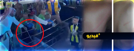 فيديو صادم للدولي المغربي حمد الله وهو يتعرض لاعتداء بالسوط فيديو صادم للدولي المغربي حمد الله وهو يتعرض لاعتداء بالسوط