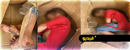 متسولة في الناظور تعذب ابنها بالنار.. وهذا ما قامت به مصالح الأمن متسولة في الناظور تعذب ابنها بالنار.. وهذا ما قامت به مصالح الأمن