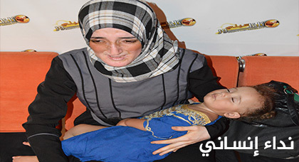 الطفلة فاطمة الزهراء تحتاج لعملية جراحية ثانية على القلب الطفلة فاطمة الزهراء تحتاج لعملية جراحية ثانية على القلب