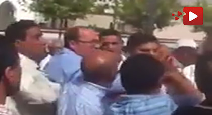  الصحافي الريفي عبد المجيد أمياي يتعرض لإعتداء على يد أحد المرشحين لإنتخابات الغرف المهنية 