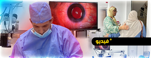 قافلة طبية بإقليم الناظور.. جراحة قافلة طبية بإقليم الناظور.. جراحة
