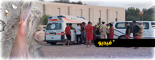 جيت سكي تتسبب في إصابة بليغة لأحد المصطافين بشاطئ أركمان جيت سكي تتسبب في إصابة بليغة لأحد المصطافين بشاطئ أركمان