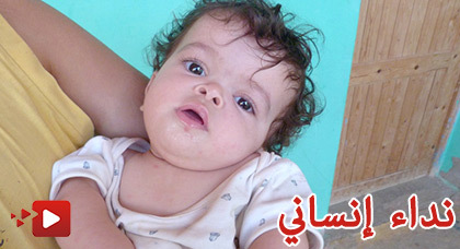 طفلة تعاني من مرض في عمودها الفقري تناشد المحسنين لإعانتها في إجراء العملية طفلة تعاني من مرض في عمودها الفقري تناشد المحسنين لإعانتها في إجراء العملية