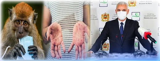 وزير الصحة يعقد اجتماعا طارئا حول وباء وزير الصحة يعقد اجتماعا طارئا حول وباء