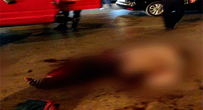قطعة نقدية قيمتها 5 دراهم كادت تزهق روح شابٍّ تلقّى عنها غرس آلة حادة في بطنه بالناظور قطعة نقدية قيمتها 5 دراهم كادت تزهق روح شابٍّ تلقّى عنها غرس آلة حادة في بطنه بالناظور