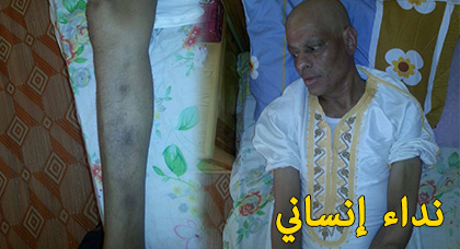 نور الدين ينادي القلوب الرحيمة من أجل مساعدته للعلاج من سرطان الدم الفتاك نور الدين ينادي القلوب الرحيمة من أجل مساعدته للعلاج من سرطان الدم الفتاك