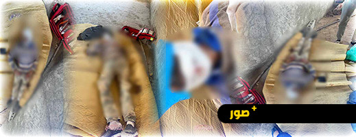 إصابة خمسيني بجروح وكسور خطيرة بعد سقوطه من الطابق الثاني لفيلا بقرية أركمان إصابة خمسيني بجروح وكسور خطيرة بعد سقوطه من الطابق الثاني لفيلا بقرية أركمان