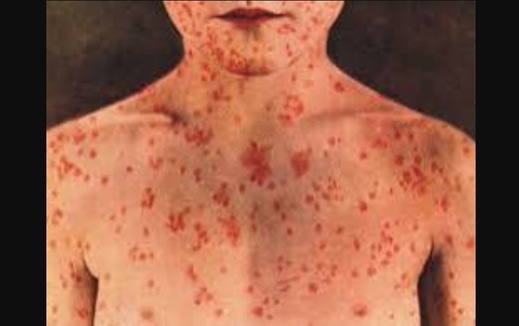 اعتبارا من الإثنين.. الآباء ملزمون بالتوجه لتقليح أبنائهم اعتبارا من الإثنين.. الآباء ملزمون بالتوجه لتقليح أبنائهم