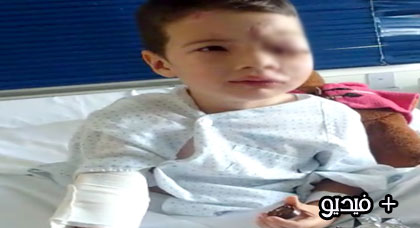 بالفيديو.. الطفل ضحية قطار الناظور يتجاوز مرحلة الخطر وينقل إلى مدريد بالفيديو.. الطفل ضحية قطار الناظور يتجاوز مرحلة الخطر وينقل إلى مدريد
