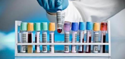 فرص عمل بمختبر تحاليل طبية في الناظور فرص عمل بمختبر تحاليل طبية في الناظور