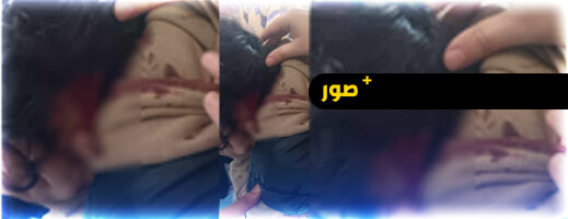تلميذ يعتدي على زميلته ويتسبب لها في نزيف بالعروي  تلميذ يعتدي على زميلته ويتسبب لها في نزيف بالعروي