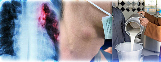 تزايد حالات السل اللمفاوي يسائل ضعف مراقبة سلاسل توزيع الحليب تزايد حالات السل اللمفاوي يسائل ضعف مراقبة سلاسل توزيع الحليب