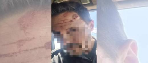 مهاجر إفريقي يهاجم حارس حدود إسباني بسلاح حاد في سبتة.. ومطالب بزيادة القوات مهاجر إفريقي يهاجم حارس حدود إسباني بسلاح حاد في سبتة.. ومطالب بزيادة القوات