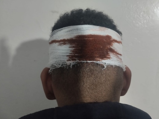 اعتداء عنيف على باحث في سلك "الدكتوراه" بعدما ضبط طالبا يغش في امتحانات شعبة الأمازيغية اعتداء عنيف على باحث في سلك "الدكتوراه" بعدما ضبط طالبا يغش في امتحانات شعبة الأمازيغية