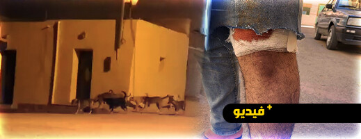 الكلاب الضالة تثير الرعب بحي بويزازان بالناظور.. 7 ضحايا ومطالب للجماعة بالتدخل الكلاب الضالة تثير الرعب بحي بويزازان بالناظور.. 7 ضحايا ومطالب للجماعة بالتدخل