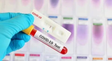 منظمة الصحة تحذر من متحور جديد لكورونا والمغرب مطالب باتخاذ تدابير استباقية منظمة الصحة تحذر من متحور جديد لكورونا والمغرب مطالب باتخاذ تدابير استباقية