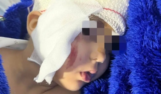 تفاصيل  توقيف المتورط في دهس الطفلة غيتة بشاطئ سيدي رحال