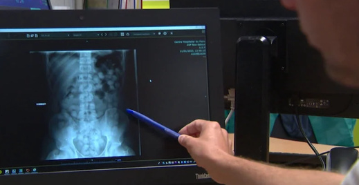 موقوف يلفظ أنفاسه بعد ابتلاعه كيسًا يحتوي على مخدرات موقوف يلفظ أنفاسه بعد ابتلاعه كيسًا يحتوي على مخدرات