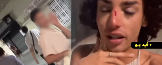 اعتقال قاصر مغربي في إسبانيا بعد اعتدائه على شاب مثلي بزجاجة اعتقال قاصر مغربي في إسبانيا بعد اعتدائه على شاب مثلي بزجاجة