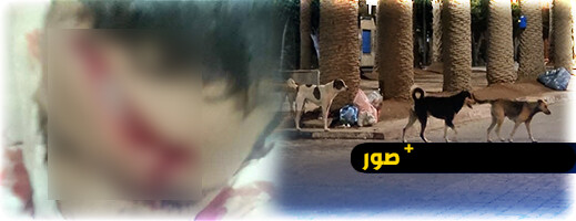  هجوم كلاب ضالة يصيب طفلين بجروح خطيرة بالناظور