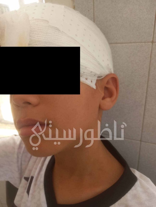 فاجعة مؤلمة بالناظور.. وفاة طفل بعد 21 يومًا من عضة كلب ضال وسط مطالب بفتح تحقيق ومحاسبة المسؤولين فاجعة مؤلمة بالناظور.. وفاة طفل بعد 21 يومًا من عضة كلب ضال وسط مطالب بفتح تحقيق ومحاسبة المسؤولين