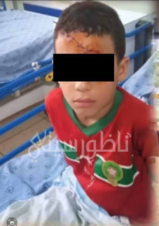 فاجعة مؤلمة بالناظور.. وفاة طفل بعد 21 يومًا من عضة كلب ضال وسط مطالب بفتح تحقيق ومحاسبة المسؤولين فاجعة مؤلمة بالناظور.. وفاة طفل بعد 21 يومًا من عضة كلب ضال وسط مطالب بفتح تحقيق ومحاسبة المسؤولين