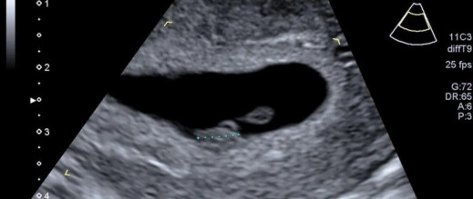 تخمينات الأطباء تقادمت.. الذكاء الاصطناعي يتنبأ بموعد ولادة الأطفال بدقة عالية تخمينات الأطباء تقادمت.. الذكاء الاصطناعي يتنبأ بموعد ولادة الأطفال بدقة عالية