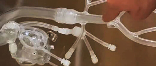 سابقة علمية.. الدكتور المغربي يوسف العزوزي يخترع أول جهاز لتوجيه الخلايا داخل الدم سابقة علمية.. الدكتور المغربي يوسف العزوزي يخترع أول جهاز لتوجيه الخلايا داخل الدم