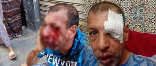 اعتداء وحشي من أجنبي على شخص من ذوي الاحتياجات الخاصة يثير غضب ساكنة تارودانت اعتداء وحشي من أجنبي على شخص من ذوي الاحتياجات الخاصة يثير غضب ساكنة تارودانت