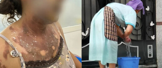 طرد عاملة منزلية بعد تعرضها لحروق بليغة واتهامها بالسرقة طرد عاملة منزلية بعد تعرضها لحروق بليغة واتهامها بالسرقة