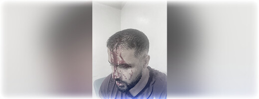"اعتداء عنيف".. توقيف شخص اعتدى على طبيب بمستشفى 