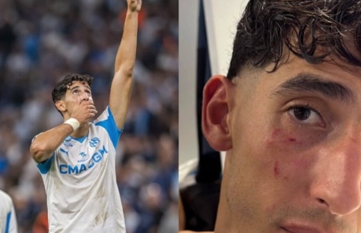 أكرد يكشف عن حيثيات تعرضه للاعتداء بمطار مارسيليا ويطمئن جماهيره أكرد يكشف عن حيثيات تعرضه للاعتداء بمطار مارسيليا ويطمئن جماهيره