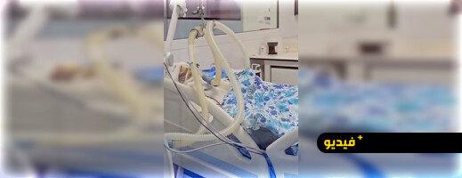 مصدر طبي يفند رواية وفاة الفنان “سوليت”