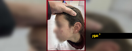 تعنيف تلميذة يجر أستاذة إلى شكاية رسمية بالناظور