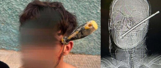 إسبانيا.. شاب مغربي ينجو من موت محقق بعد تعرضه لاعتداء من طرف جزائري بسبب خلاف مالي