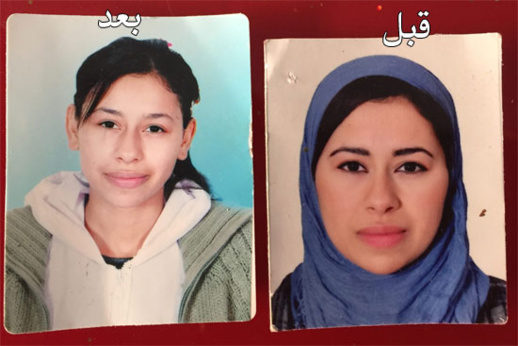 أم لـ7 أبناء بالعروي تستجدي المحسنين والجمعيات إرجاع البسمة على ثغر إبنتها المصابة بمرض غريب أم لـ7 أبناء بالعروي تستجدي المحسنين والجمعيات إرجاع البسمة على ثغر إبنتها المصابة بمرض غريب