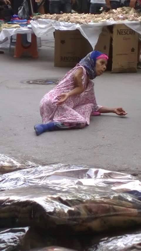 بالصور.. شاهد كيف تتحايل هذه السيدة على المارة لاستجداء تعاطفهم 