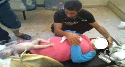 درّاجو "طواف المغرب" يتسببون في وضع إمرأة لحملها داخل سيارة خطّاف بأركمان
