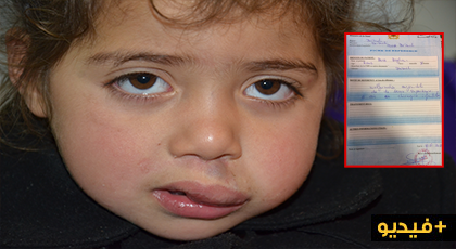 سيدة من الدريوش تناشد المحسنين مساعدتها على علاج إبنتها من تشوه خلقي سيدة من الدريوش تناشد المحسنين مساعدتها على علاج إبنتها من تشوه خلقي