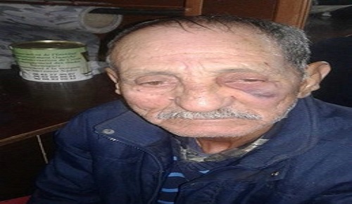 مجهولون مدججون بالأسلحة البيضاء يعتدون على مسن ثمانيني ويسرقون حاجياته بالناظور