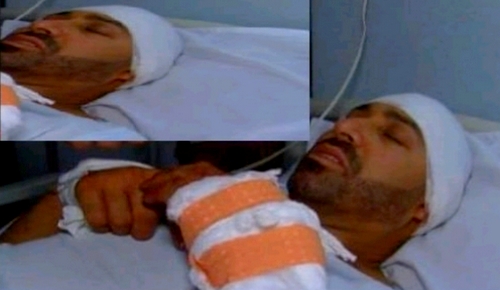 ينحدر من جماعة عين زورة.. عصابة بطنجة تسلب مواطن 54 مليون سنتيم وتصيبه بجروح بليغة ينحدر من جماعة عين زورة.. عصابة بطنجة تسلب مواطن 54 مليون سنتيم وتصيبه بجروح بليغة