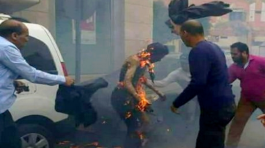 وفاة ثلاثيني داخل المستشفى الحسني بالناظور متأثرا بحروق من الدرجة الثالثة