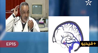 الجهاز العصبي... موضوع حلقة اليوم من برنامج "نصائح طبية" على الشاشة الأمازيغية